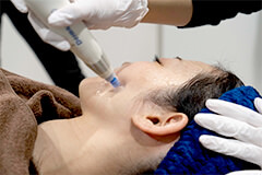 施術手順2イメージ