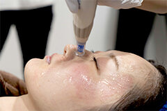 施術手順3イメージ